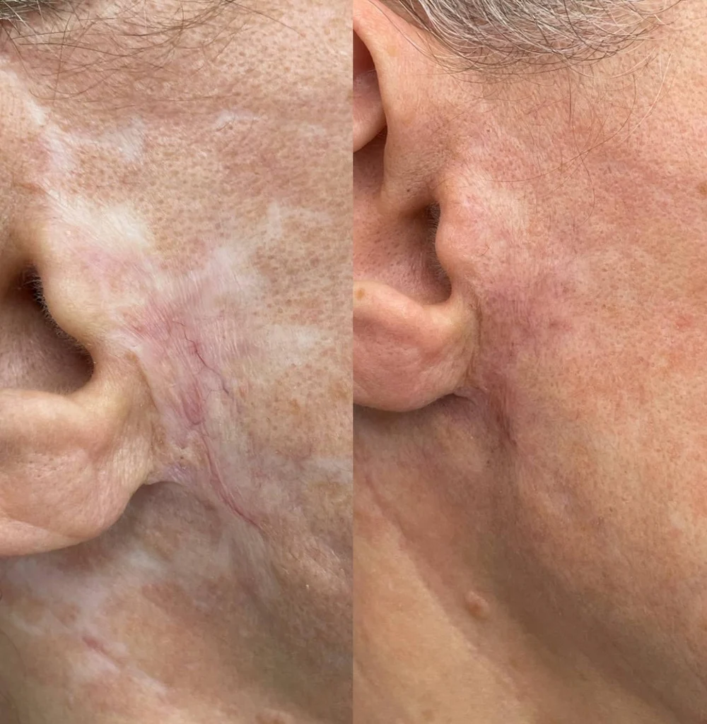 Мастер перманентного макияжа